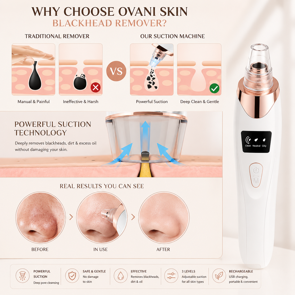 Ovani Blackhead Remover Vacuum Kit