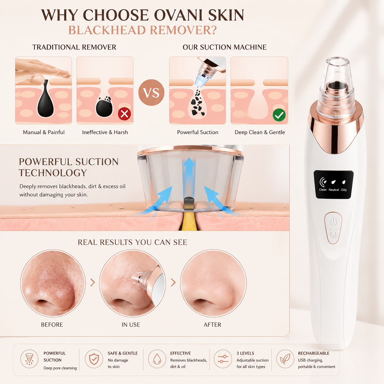 Ovani Blackhead Remover Vacuum Kit
