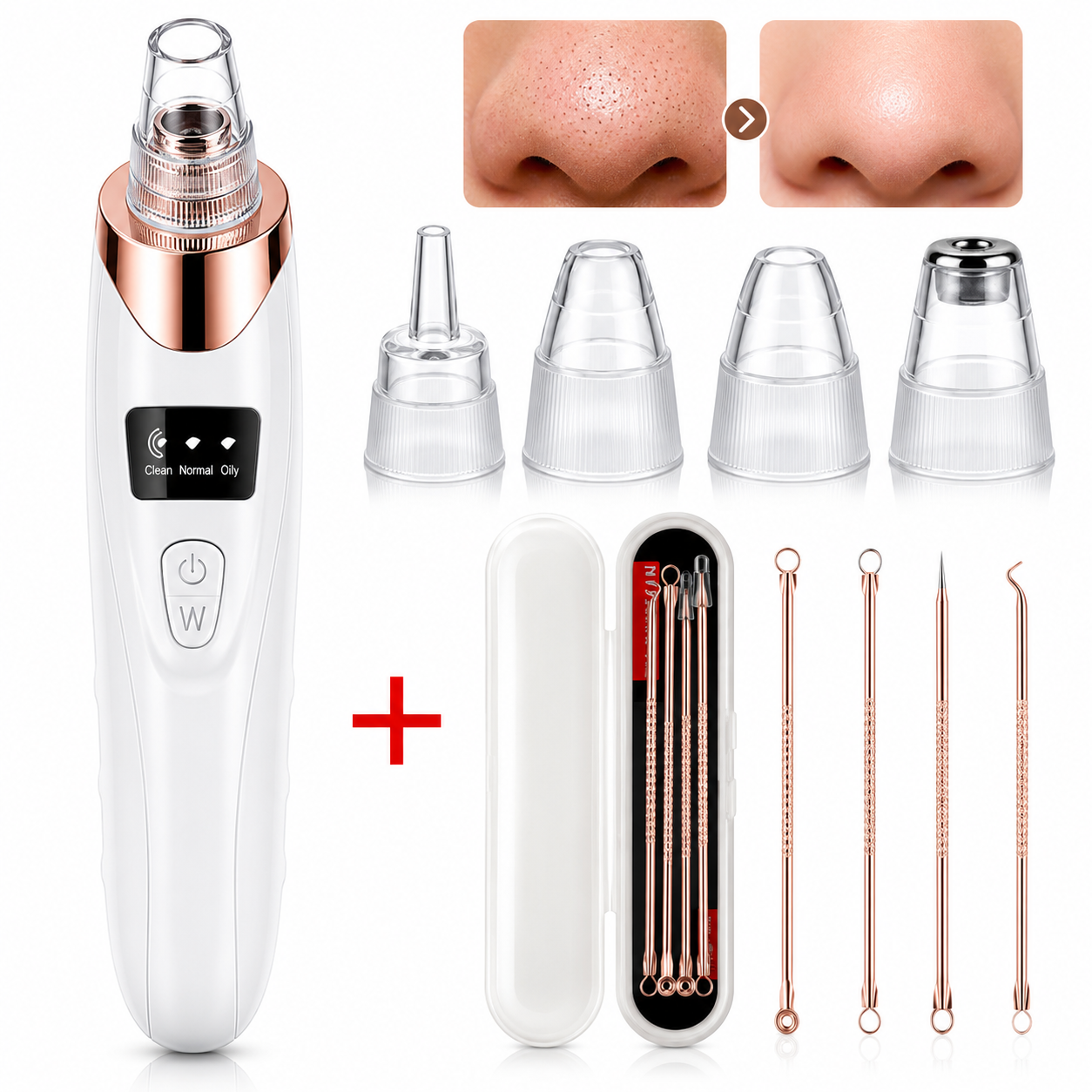 Ovani Blackhead Remover Vacuum Kit